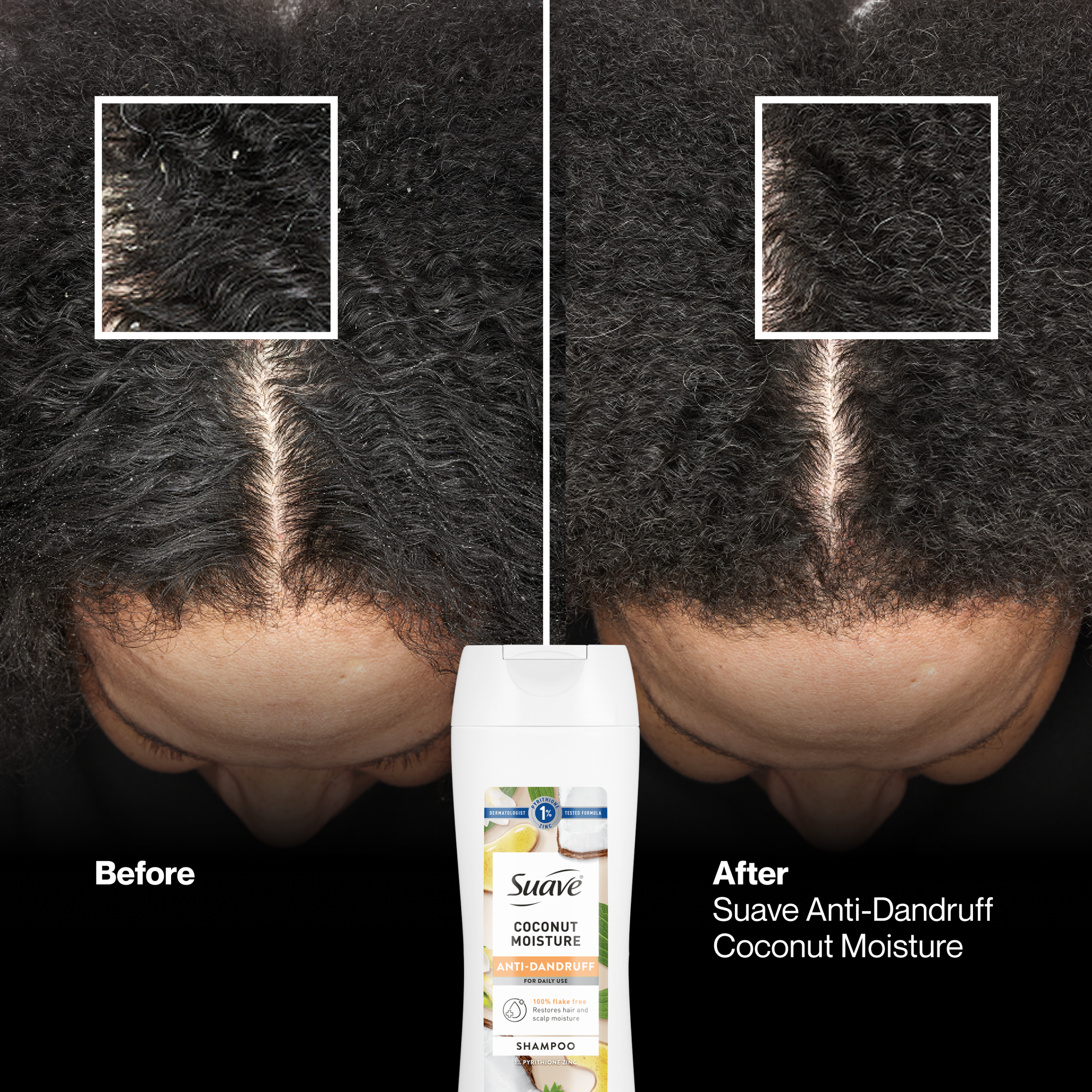 Coconut Moisture Anti Dandruff Shampoo - Image 4